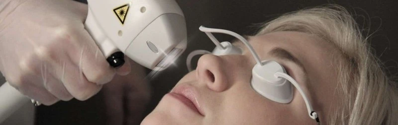 IPL Hair Removal Treatment IPL Hair Removal Treatment